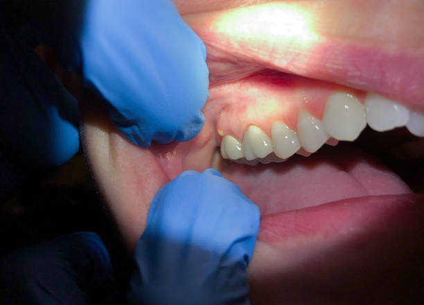 Best Emergency Dental Care for Broken or Chipped Teeth in Phoenix, AZ